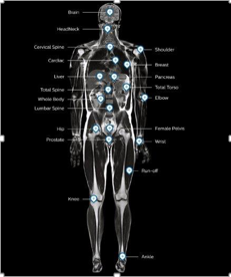 MR Body map fieldstrength