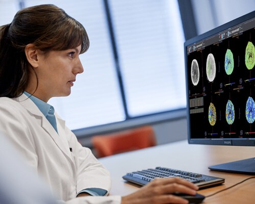 Diagnostische viewer vrouwelijke arts kijkt naar beelden Perfusie-MR