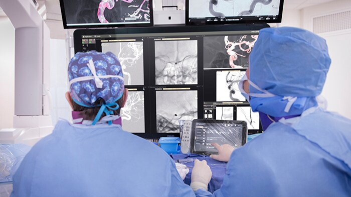 Eenvoudige bediening aan het tafelblad is een manier waarop de Azurion Neuro-suite de behandeling van beroertes vereenvoudigt voor zorgteams.