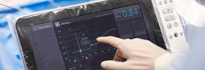 Pop-up voor CAD-behandeling ifr