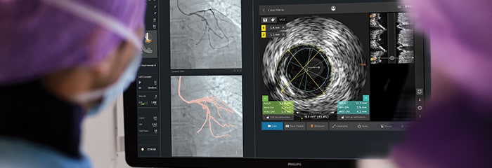 Pop-up van CAD-behandeling intrasight