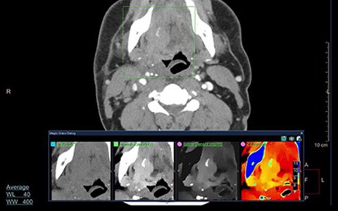 spectral-ct-video