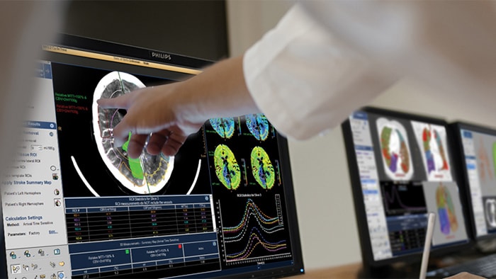Workflowoplossingen van Philips Radiology