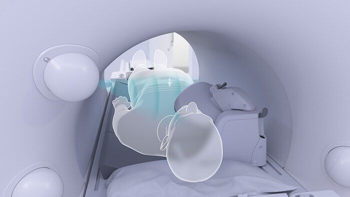 Foto van een MRI-beeldvormingssysteem en patiënt met contactloze patiëntdetectie ter voorbereiding op de scan