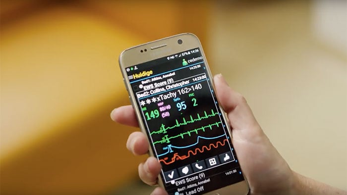 Mobiele apparaten gebruiken om bewakingsalarmen te beheren met Philips CareEvent-video