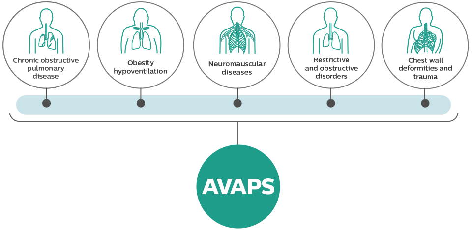 AVAPS diagram