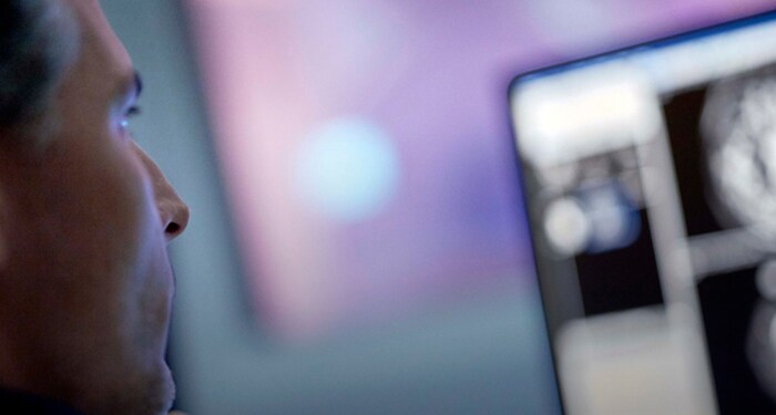 Snellere scans in alle lichaamszones met Compressed SENSE