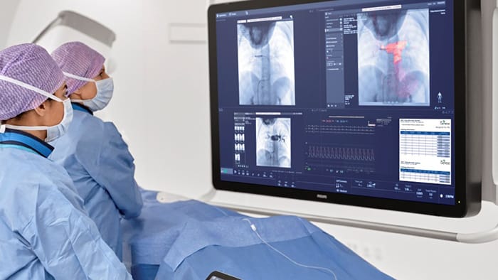 Interventies bij aangeboren hartafwijkingen