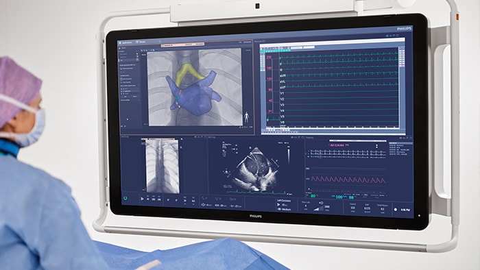 Atriumflutterprocedures
