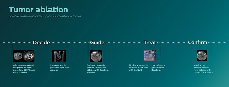 Infographic over tumorablatie