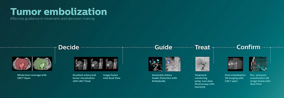 Infographic-afbeelding