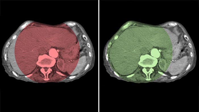 Volledige leverdekking met CBCT Open