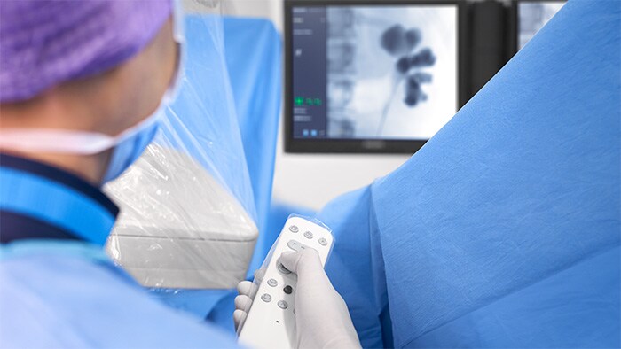 Mobiele C-bogen voor gastro-enterologie/urologie