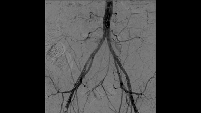 Vasculaire verwerking