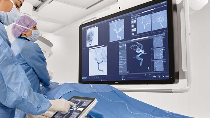Behandeling van cerebrale aneurysma's