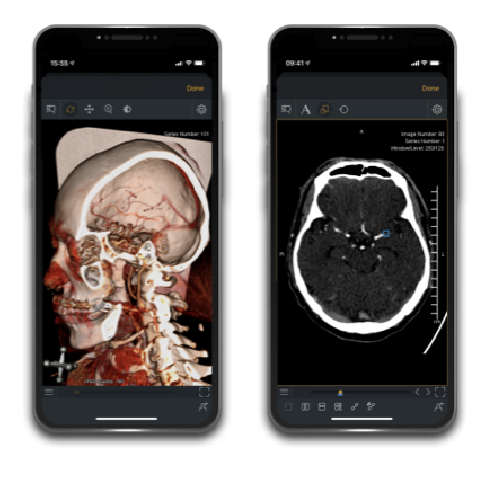Neurologie-app