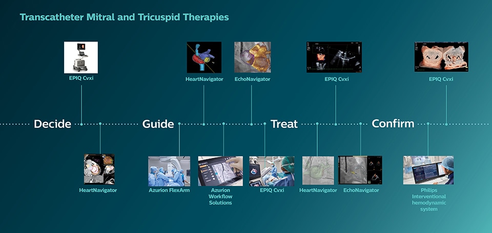 Transkatheter mitralis- en tricuspidalistherapieën