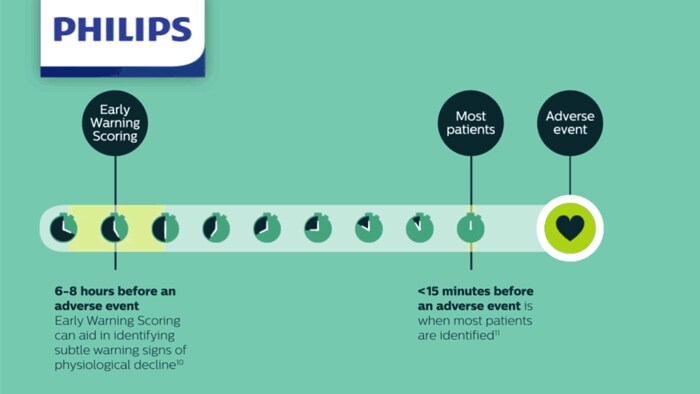 Infographic afbeelding