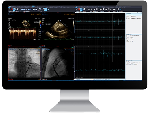 Cardiology module interface screen on a monitor