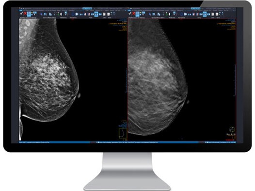 Mammography no icon