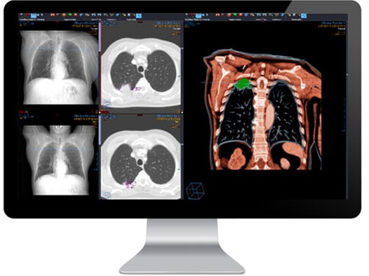 Radiology diagnostic module interface screen on a monitor