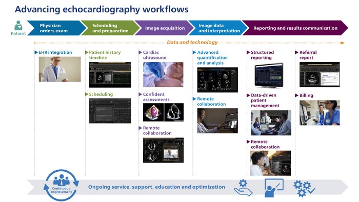 Het verbeteren van echocardiografische workflows