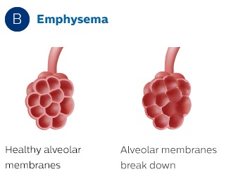 Alveolaire membranen