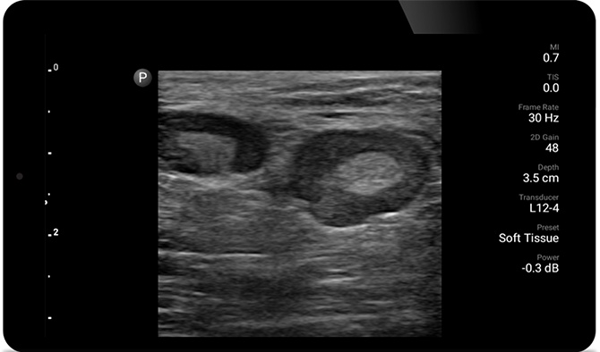 Afbeelding echografie