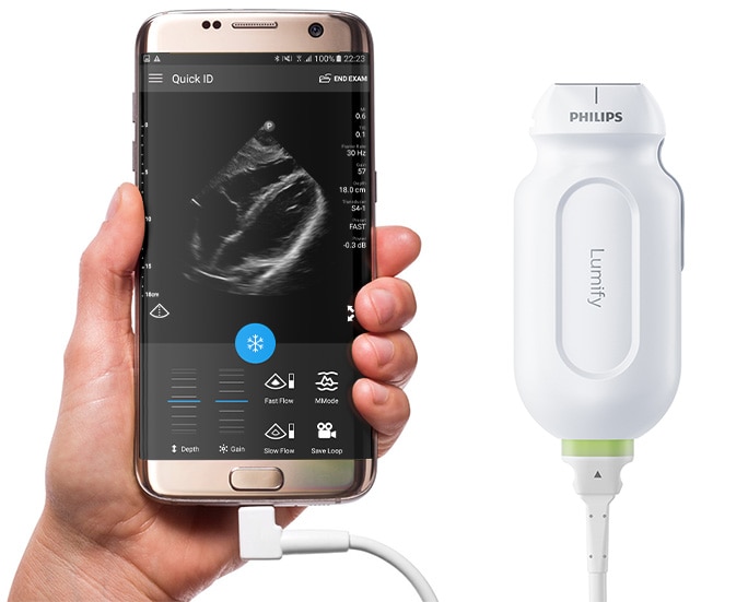 Philips Lumify