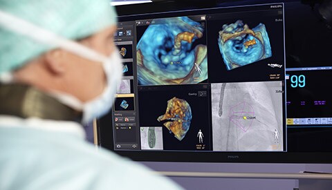 A doctor studying images for treating structural heart disease with image-guided intervention