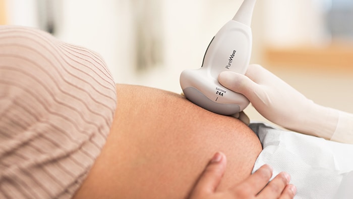 derde trimester Ultrasound dating