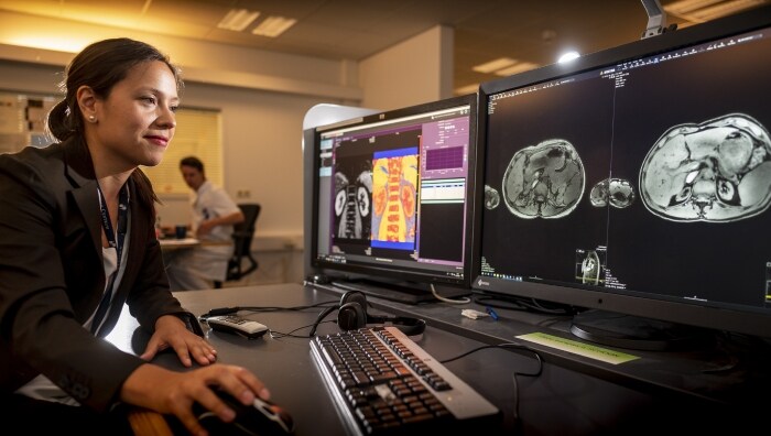 De Philipsprijs om onderzoek in radiologie verder te pushen