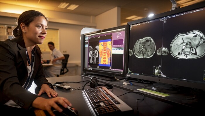 De Philipsprijs om onderzoek in radiologie verder te pushen