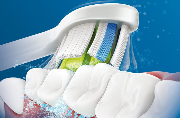 Een illustratie van een tandenborstelkop met dunne haren die een rij witte tanden poetst.