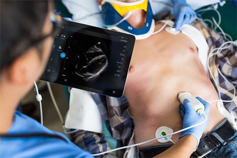 philips ultrasound nl new