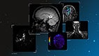 Philips to unveil suite of advanced MR-based software applications for assessment of neurological disorders at RSNA 2016