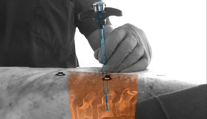 Philips Surgical Navigation Technology based on Augmented Reality (opent in een nieuw tabblad)