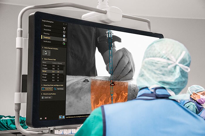 Philips Surgical Navigation Technology based on Augmented Reality (opent in een nieuw tabblad)