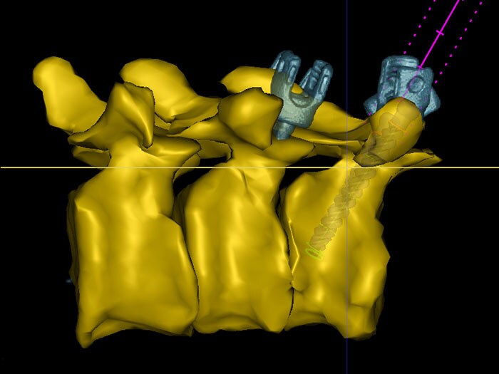 Philips Surgical Navigation Technology (opent in een nieuw tabblad)