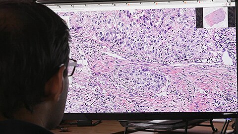 Philips en PathAI gaan een samenwerking aan om de diagnose van borstkanker te verbeteren dankzij het gebruik van artificiële intelligentie in pathologisch onderzoek met big data