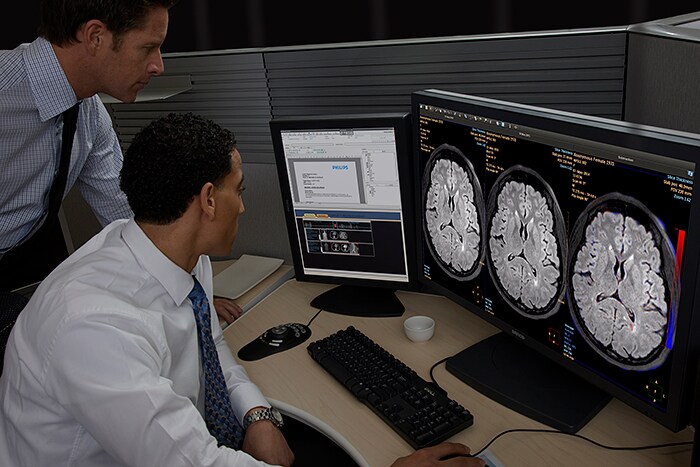 IntelliSpace Portal offers Longitudinal Brain Imaging (LoBI), an application that has been optimized for the interpretation of brain MRI scan and aims to facilitate the longitudinal evaluation of neurological disorders helping clinicians to monitor disease progression. (opent in een nieuw tabblad)