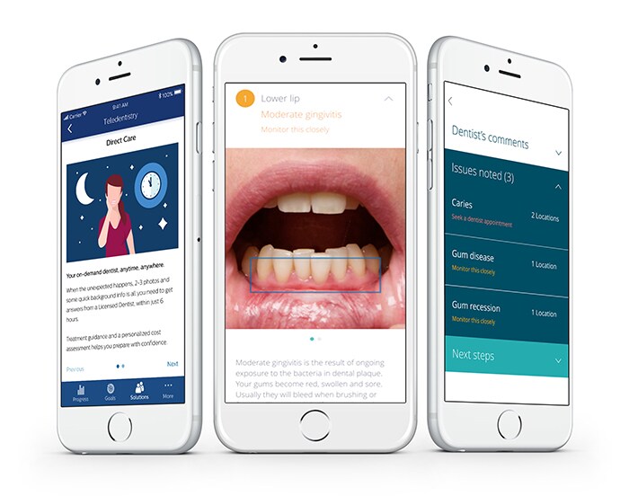 Philips Sonicare Solutions Teledentistry Service (opent in een nieuw tabblad)