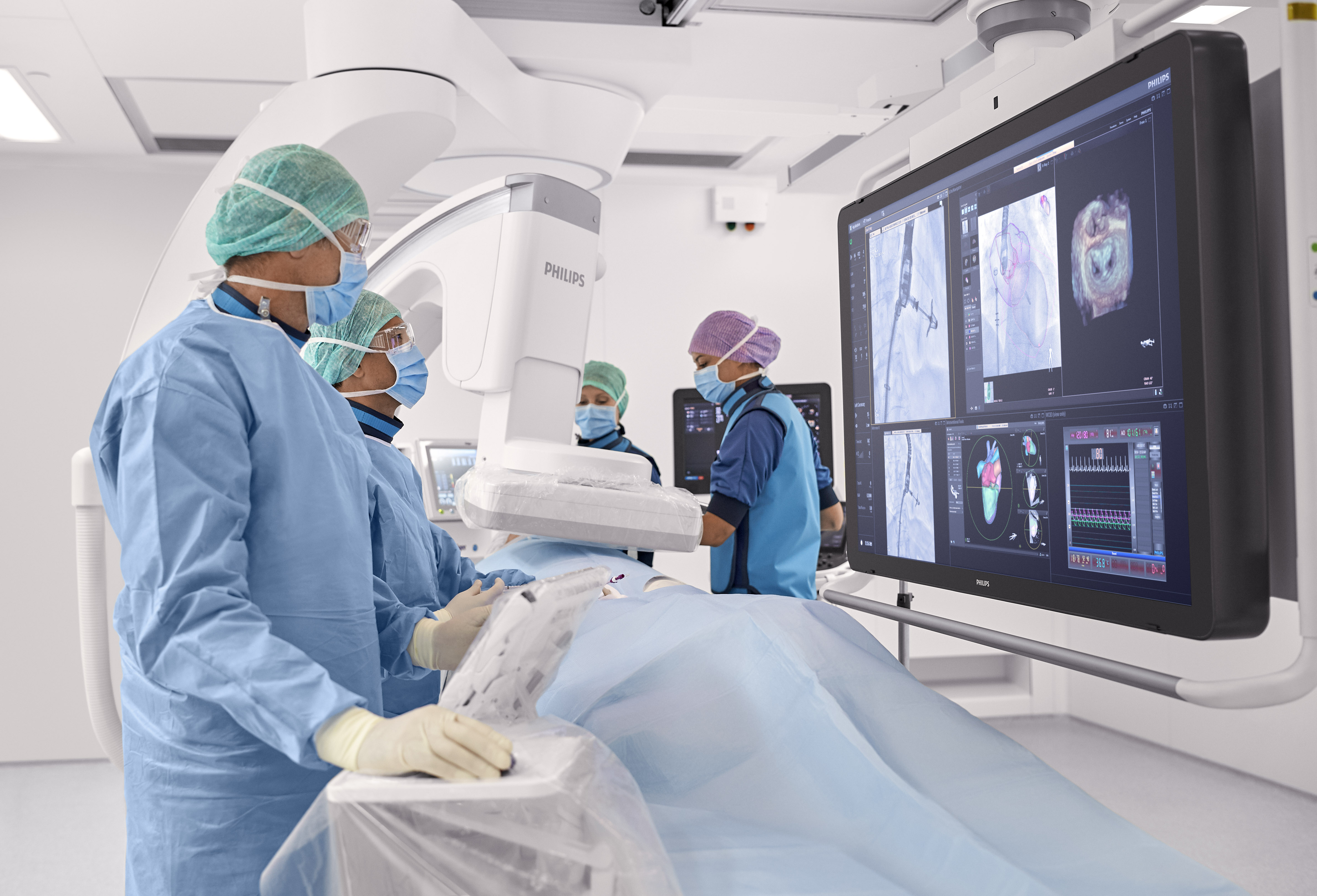 Philips lanceert Azurion met FlexArm Nieuws Philips