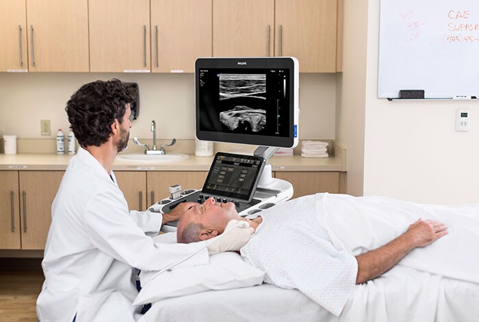 The Philips EPIQ Elite ultrasound system. (opent in een nieuw tabblad)