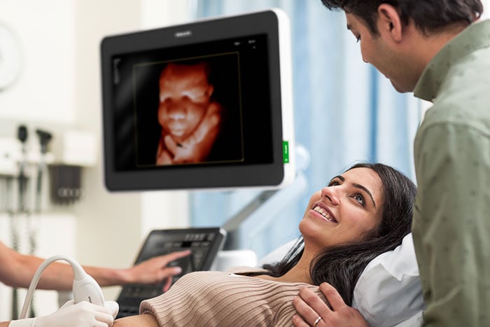 EPIQ Elite for Obstetrics & Gynecology (opent in een nieuw tabblad)