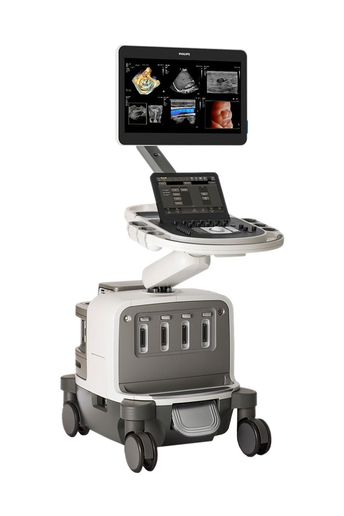 Philips EPIQ Elite ultrasound system (opent in een nieuw tabblad)