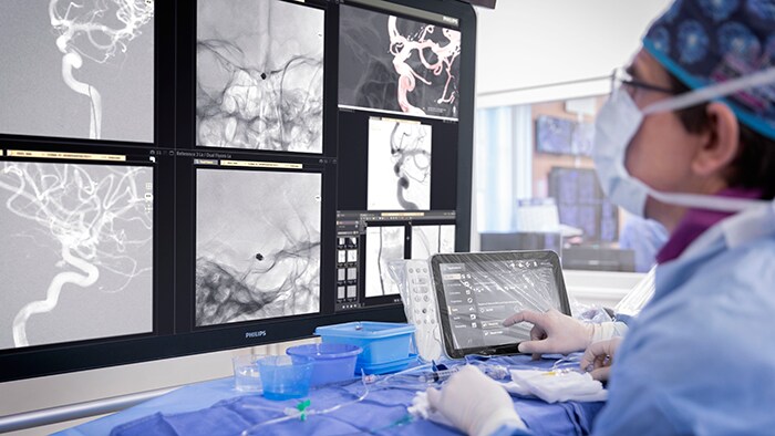 An interventional physician assesses a stroke patient on the Philips Azurion image guided therapy platform (opent in een nieuw tabblad)