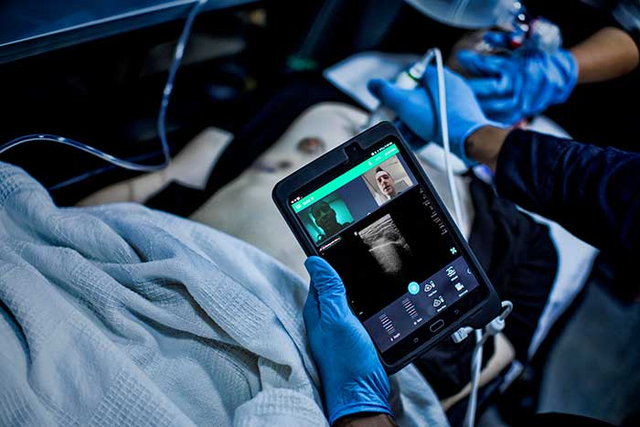 Philips Lumify tele ultrasound solution (opent in een nieuw tabblad)