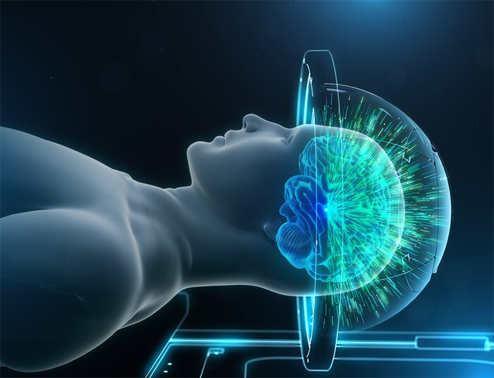 Download image (.jpg) MR guided focused ultrasound for incisionless neurosurgery (opent in een nieuw tabblad)