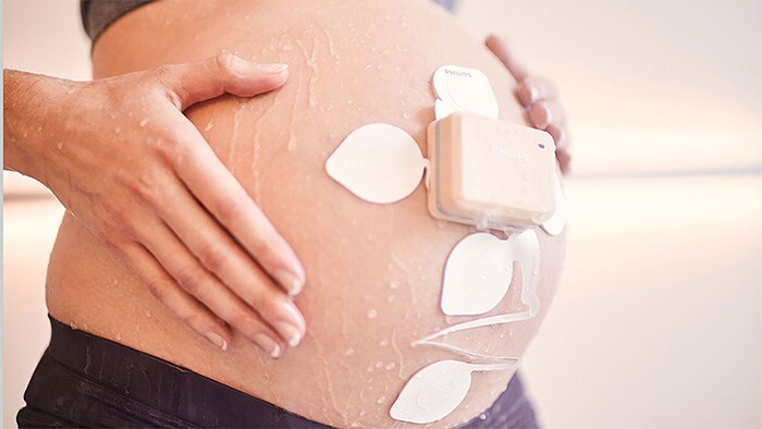 The Avalon Fetal and Maternal Pod and Patch is a single use, disposable patch placed on the mother’s abdomen to capture fetal and maternal vitals without the need for constant repositioning (opent in een nieuw tabblad)